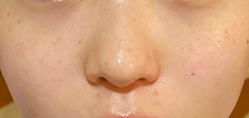 なさ on LIPS 「肌改善計画3日目今日も昨日と同じく精製水をコットンに染み込ませ..」(3枚目)