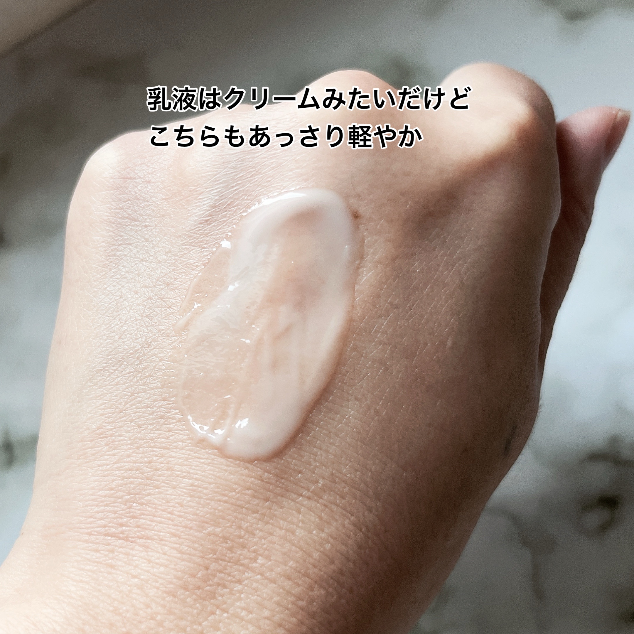 アクネケア ジェル乳液　＜医薬部外品＞/ファンケル/乳液を使ったクチコミ（3枚目）