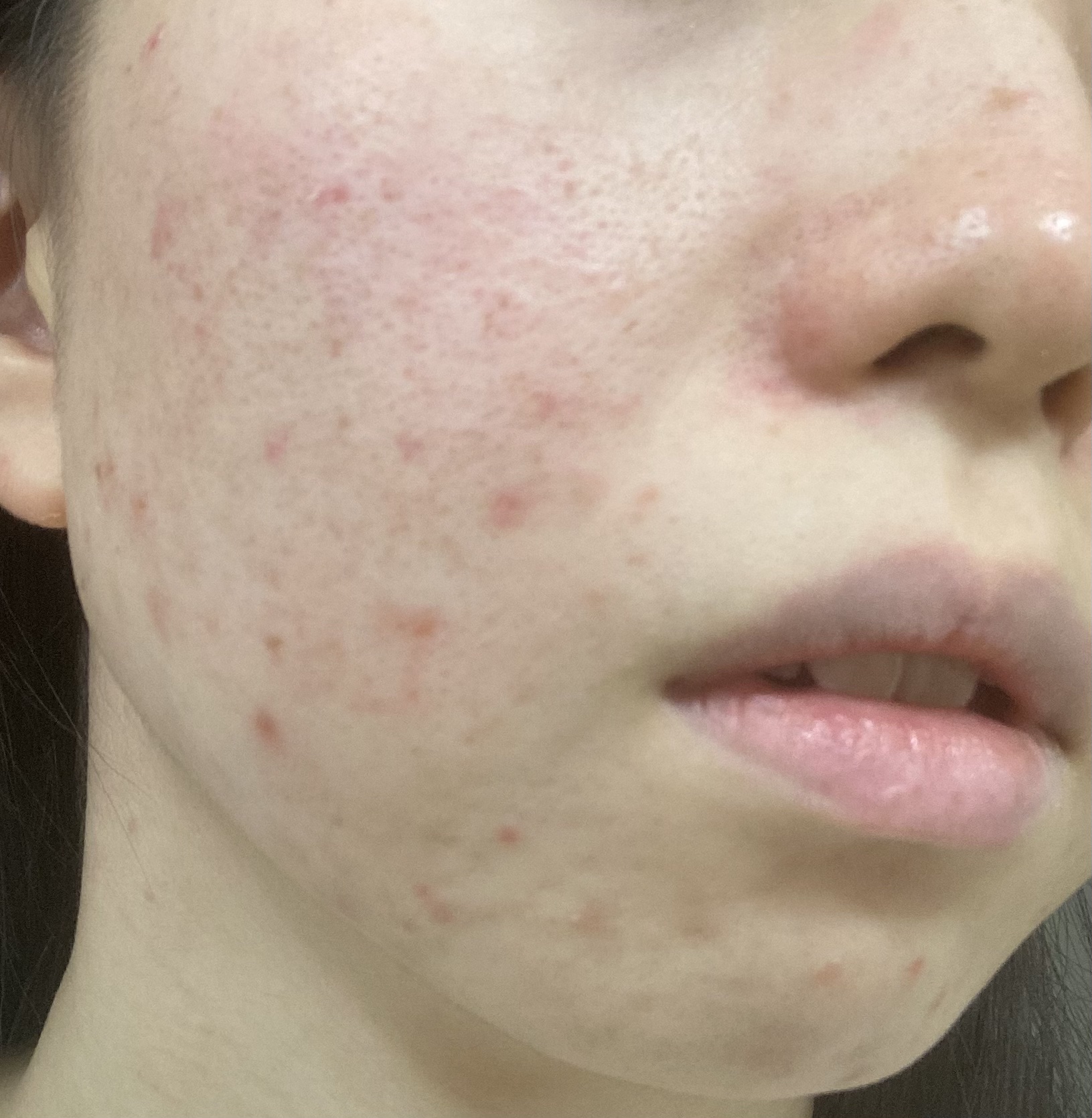 ザ・タイムR アクア/IPSA/化粧水を使ったクチコミ（2枚目）