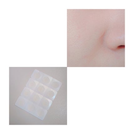 クリアパッチ/Angelab/にきびパッチを使ったクチコミ(2枚目)