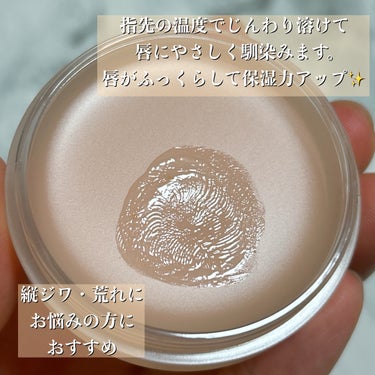 EVER MOIST LIP BALM/XOUL/リップケア・リップクリームを使ったクチコミ（3枚目）