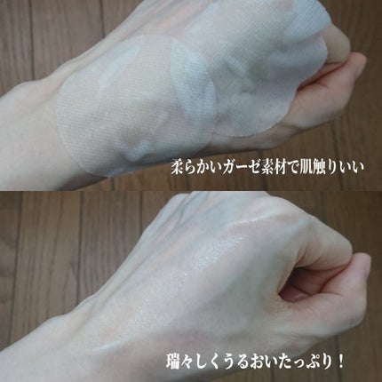 シカゴ― シカスピーディー カーミングパッド/ISOI/トナーパッドを使ったクチコミ(4枚目)