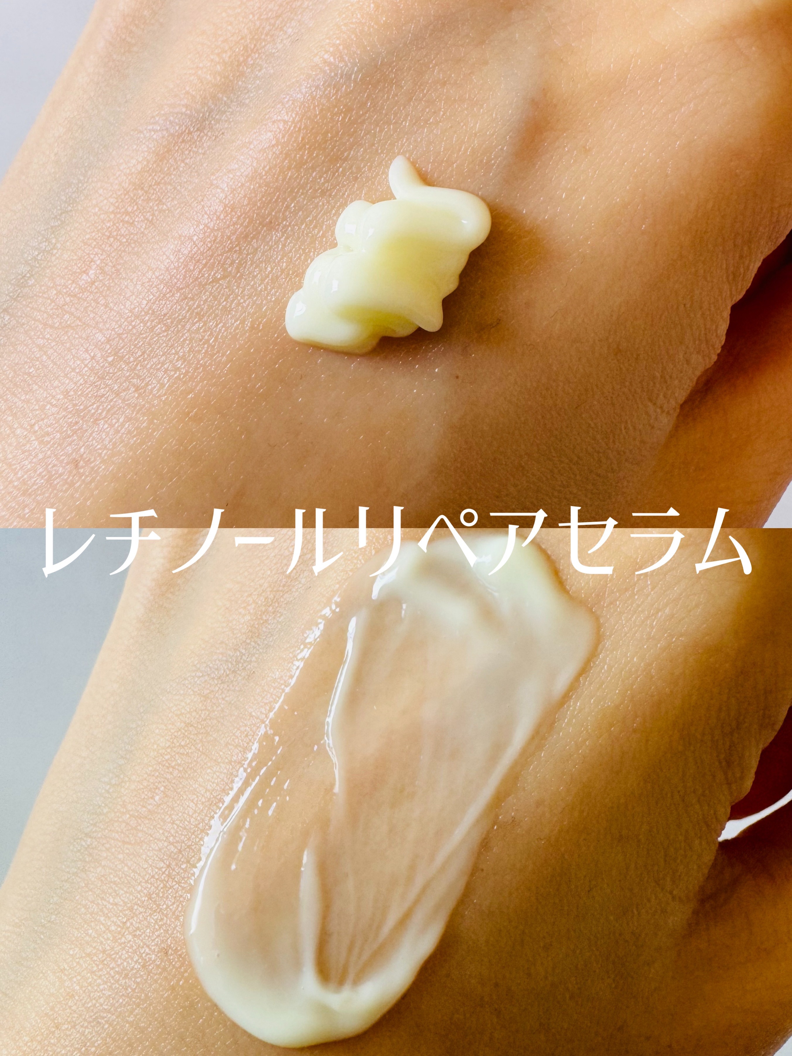 ヴィーガンリポソームレチノールセラム/SKIN&LAB/美容液を使ったクチコミ（2枚目）