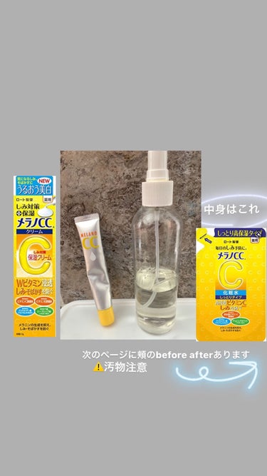 メラノCC 薬用しみ対策 美白化粧水 しっとりタイプのクチコミ「こんなにも肌荒れが改善した方法教えます！
ニキビ跡、赤らみ、肌荒れトーンアップに効果的です
ニ.....」（2枚目）