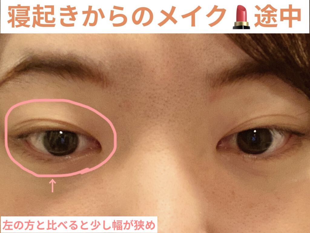 オリシキ アイリッドスキンフィルム		/D-UP/二重まぶた用アイテムを使ったクチコミ（2枚目）