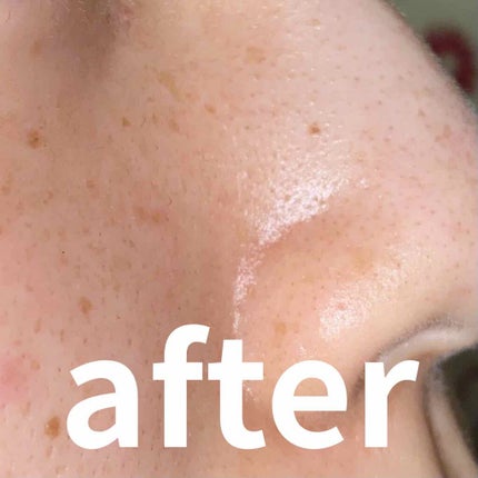 光美容器KE-NON(ケノン) ピンクゴールド(ローズ系)/エムテック/家庭用脱毛器の画像