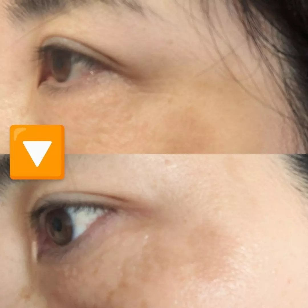 おほあんどうふ on LIPS 「面長のワタシは目元にシワができやすいんですってマスクでも隠れな..」(2枚目)