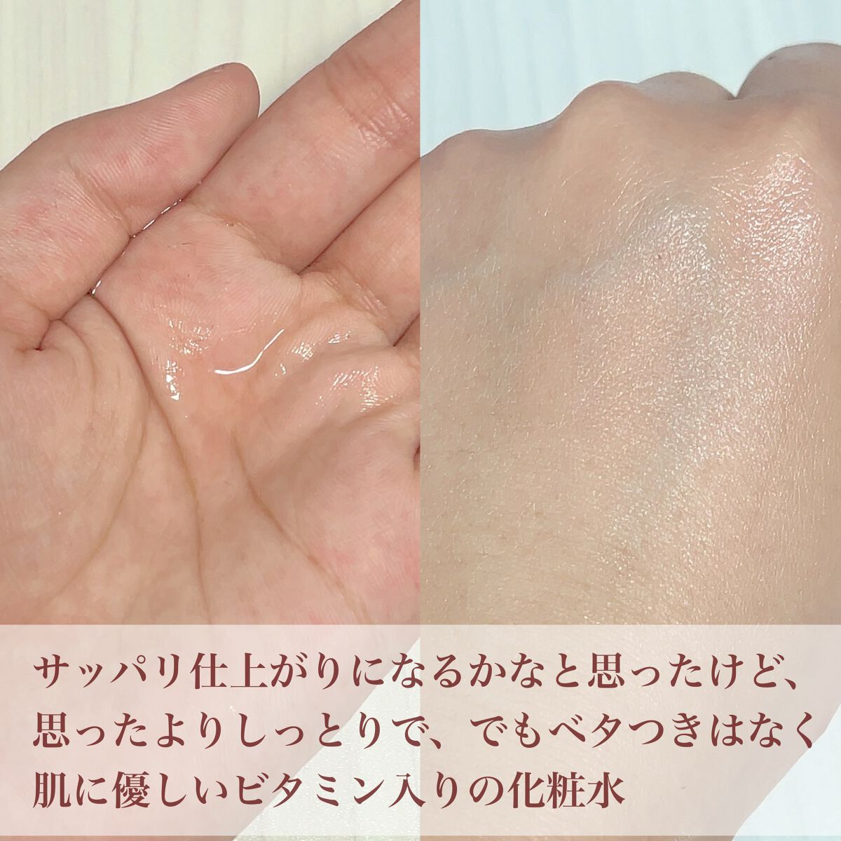 ティーツリー88%ビタミンブースティングトナー/Vertty/化粧水を使ったクチコミ（3枚目）