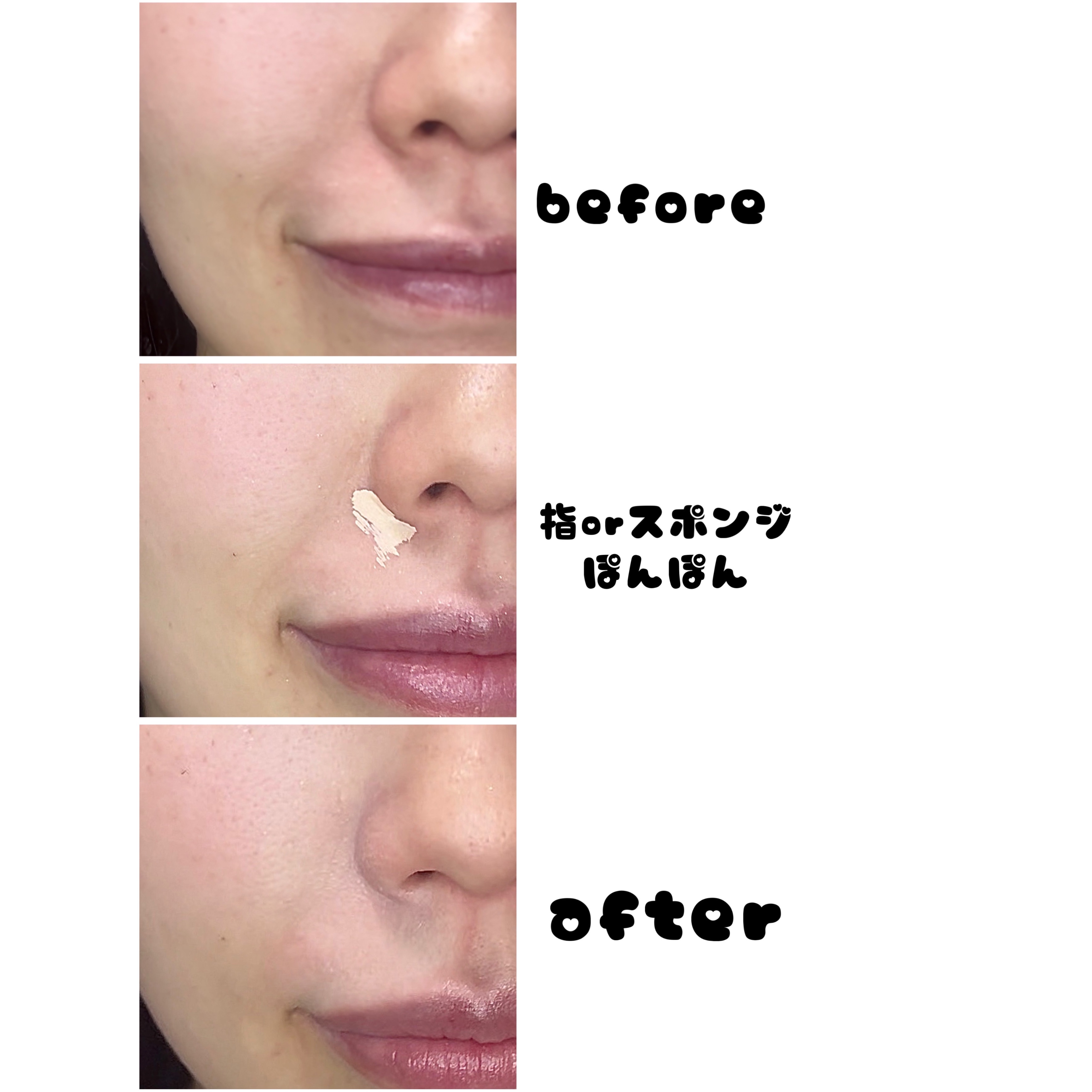 ダーマシンコンシーラー/23years old/リキッドコンシーラーを使ったクチコミ（2枚目）