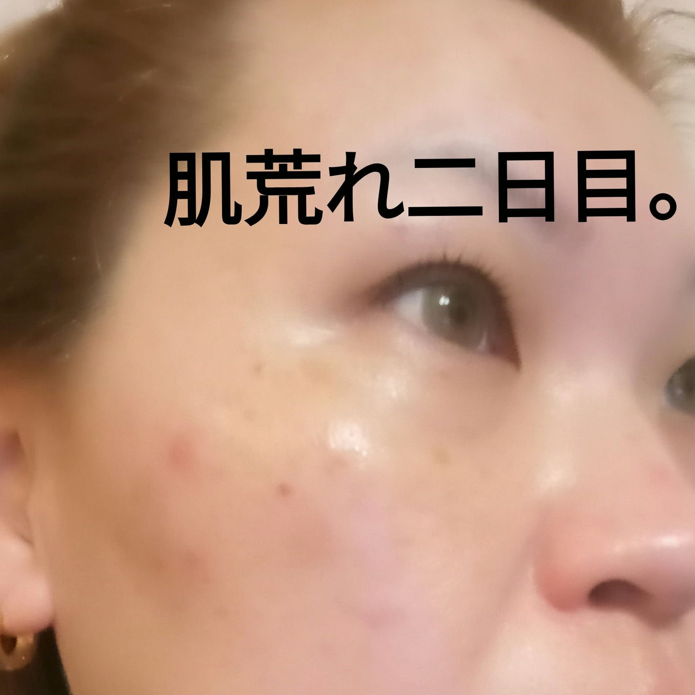 ナチュラルパック /MIRANAL/洗い流すパック・マスクを使ったクチコミ(1枚目)