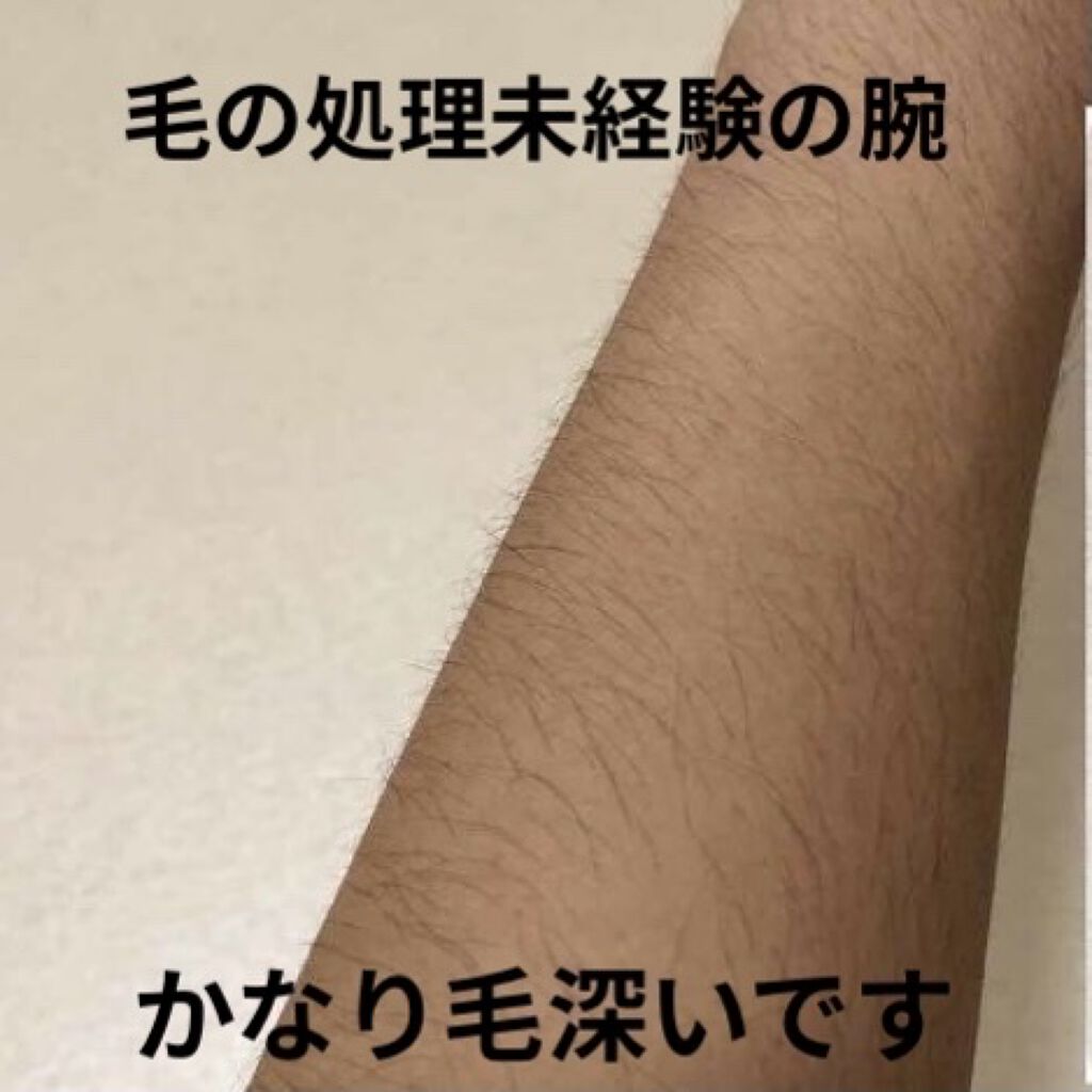 光美容器KE-NON（ケノン）/エムテック/家庭用脱毛器を使ったクチコミ（2枚目）