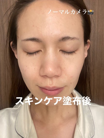 ドクダミ 77 スージングトナー/Anua/化粧水を使ったクチコミ(4枚目)