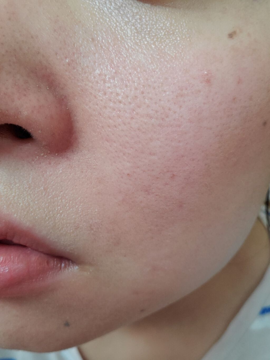 精製水（医薬品）/健栄製薬/その他を使ったクチコミ（3枚目）