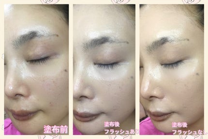 パーフェクティングフィッティング フルカバレッジクッション/LILIBETH/クッションファンデーションを使ったクチコミ(5枚目)