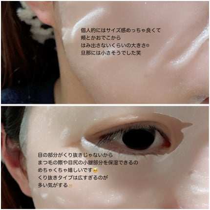 ザ・ダーマガラクトミセス /クオリティファースト/シートマスク・パックを使ったクチコミ(4枚目)