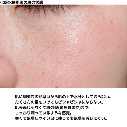 潤浸保湿 化粧水 III とてもしっとり/キュレル/化粧水を使ったクチコミ(6枚目)