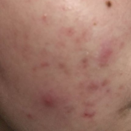 ハトムギ化粧水(ナチュリエ スキンコンディショナー R )/ナチュリエ/化粧水を使ったクチコミ(3枚目)