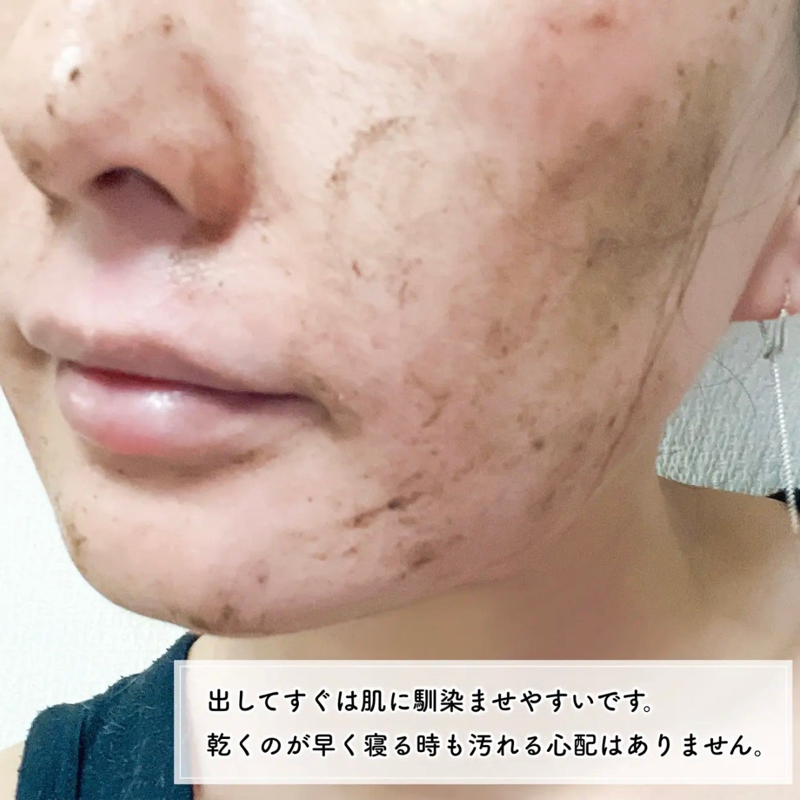 ダーマスキンピーリング/BQCELL/その他キットセットを使ったクチコミ(4枚目)