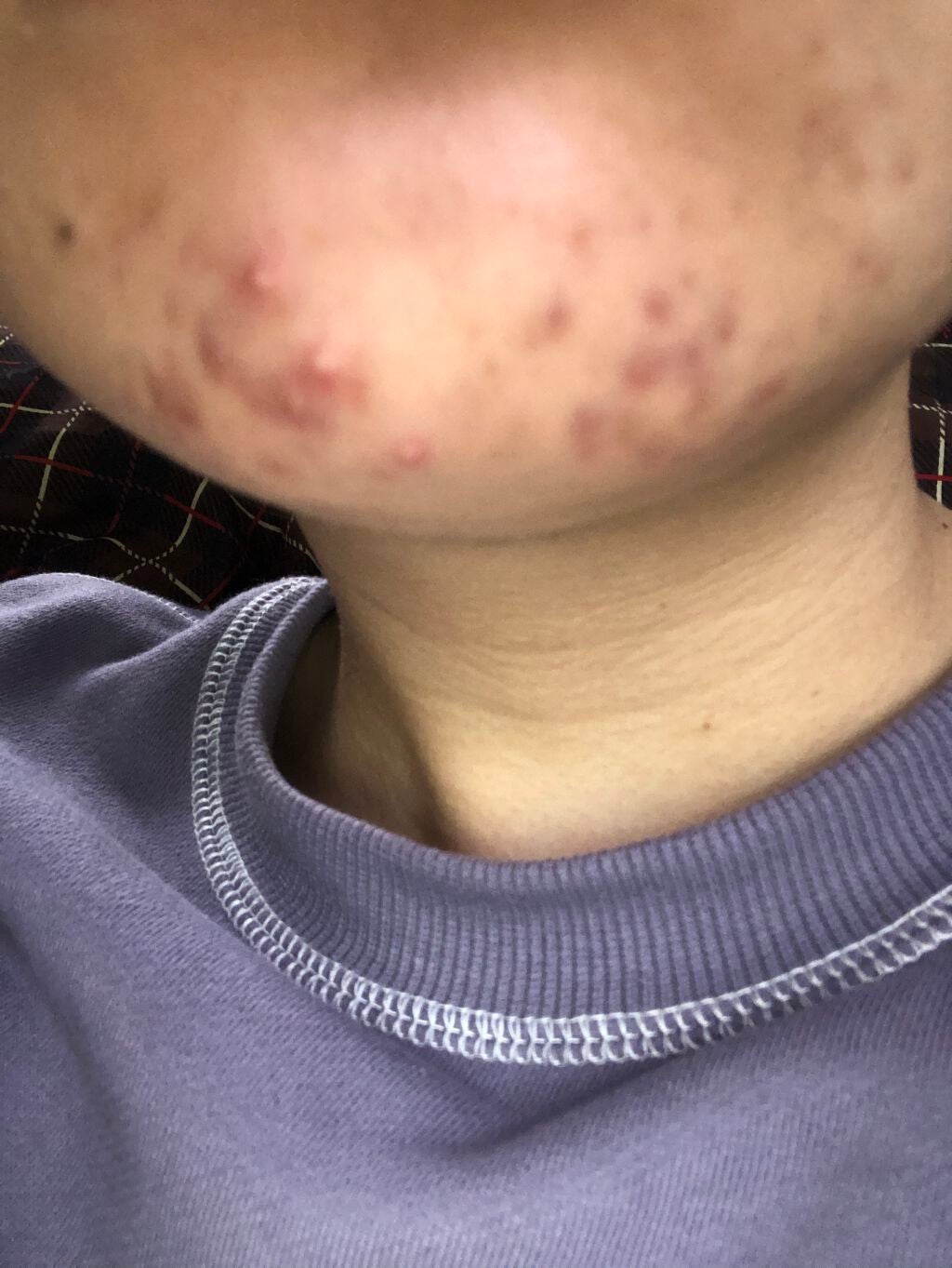 ホワイト洗顔クリーム/雪肌粋/洗顔フォームを使ったクチコミ(3枚目)