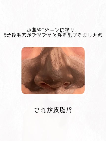 ツルリ 皮脂吸い出し 部分用パック ガスール&レッドパワー/ツルリ/洗い流すパック・マスクを使ったクチコミ(4枚目)