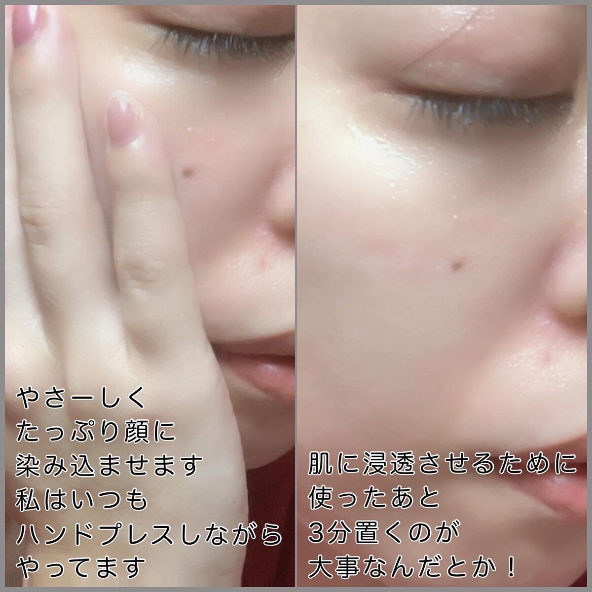 タカミスキンピール/タカミ/ブースター・導入液を使ったクチコミ(3枚目)