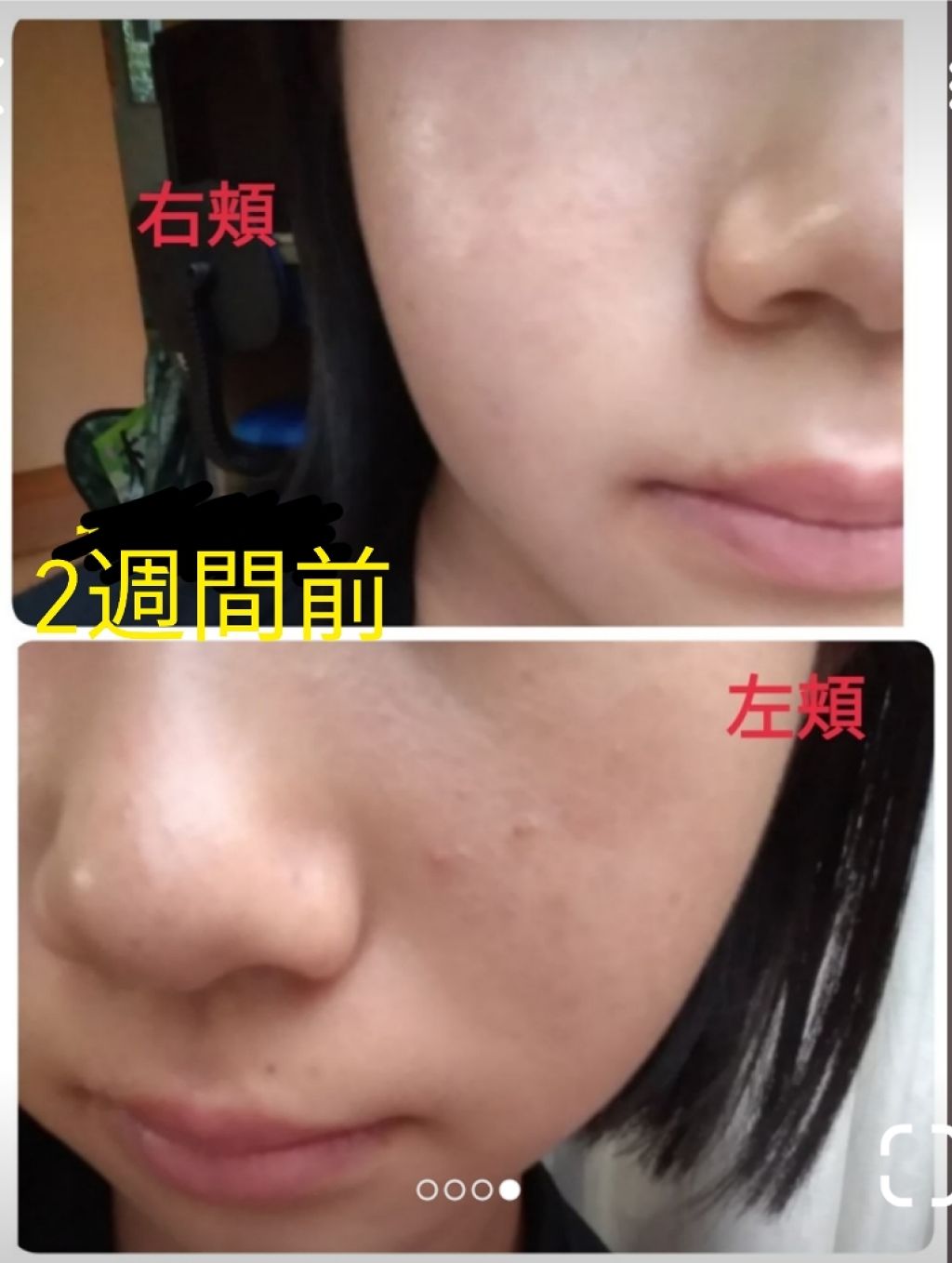 DHC ビタミンＣハードカプセル/DHC/美容サプリメントを使ったクチコミ（2枚目）