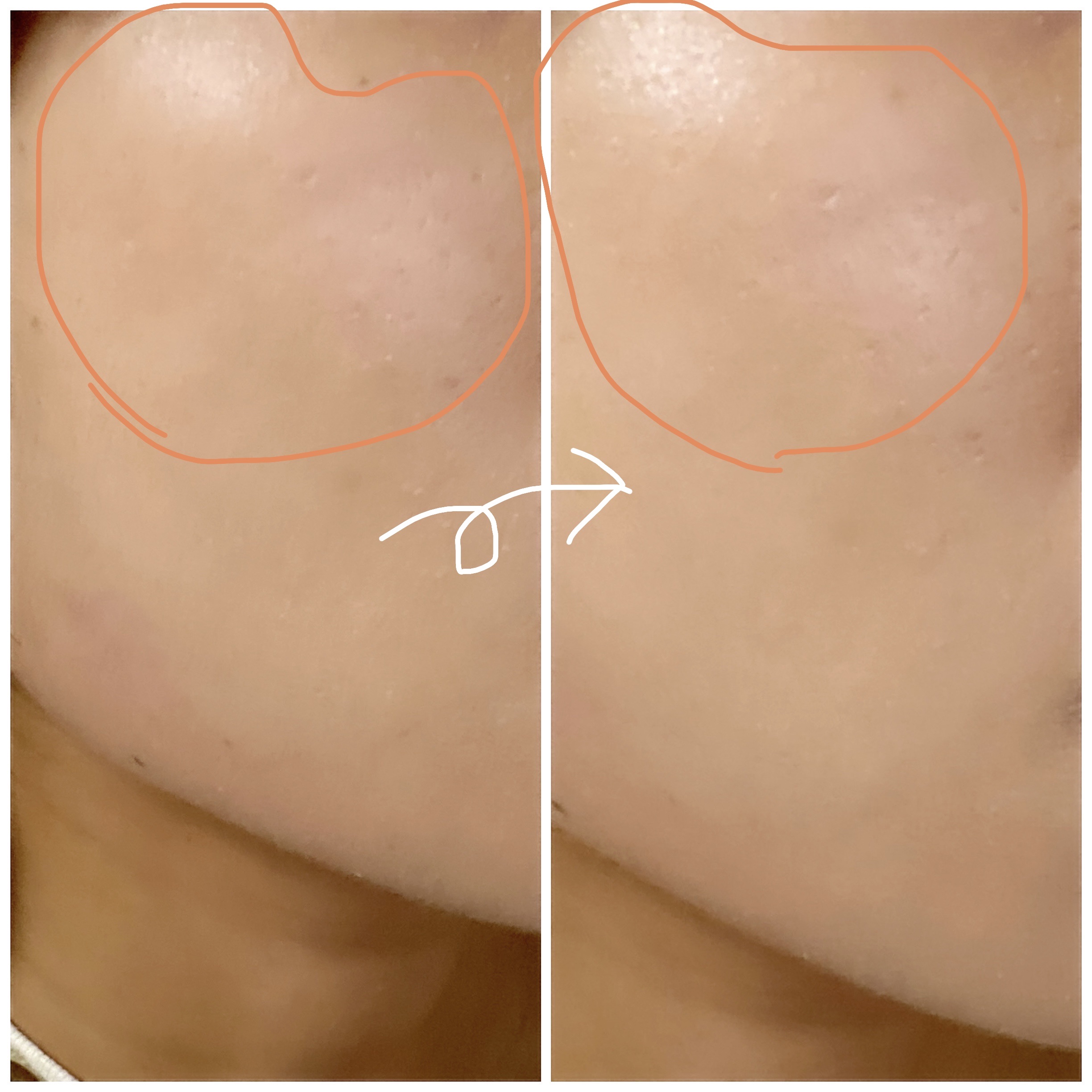 むにゅっとハイライター/キャンメイク/クリームハイライトを使ったクチコミ（2枚目）