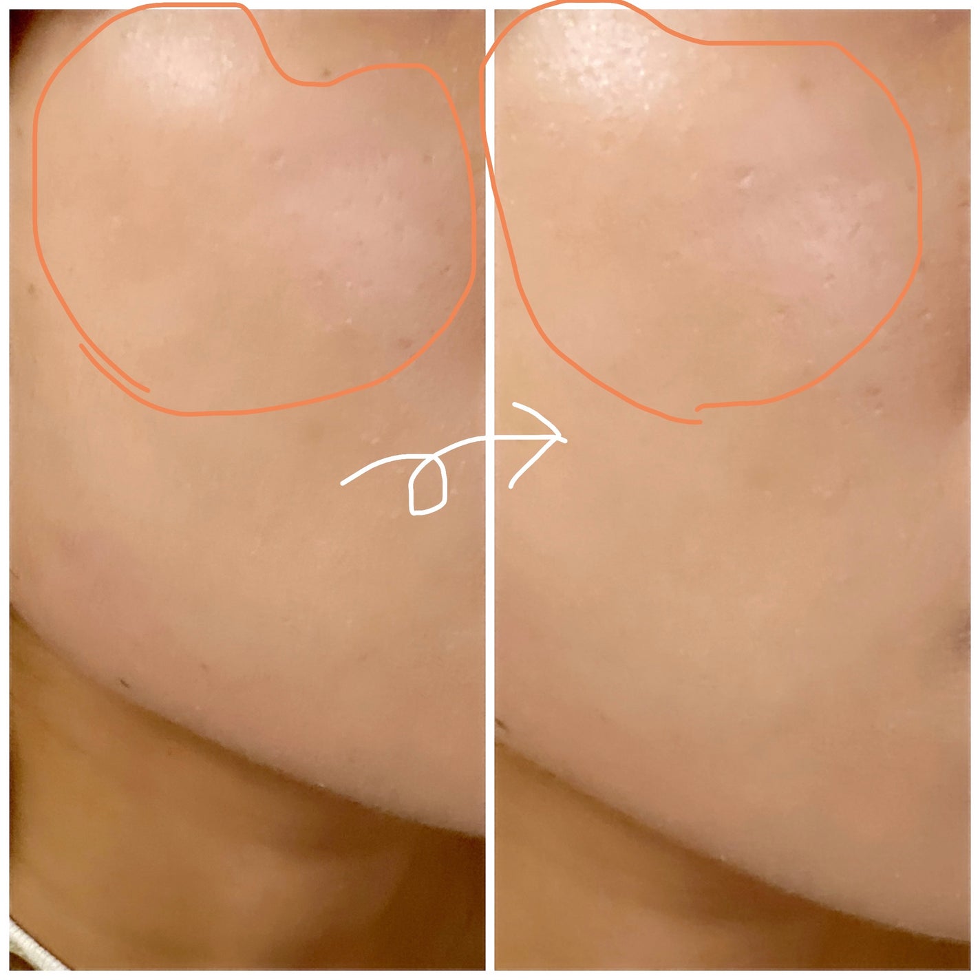 むにゅっとハイライター/キャンメイク/クリームハイライトを使ったクチコミ(2枚目)