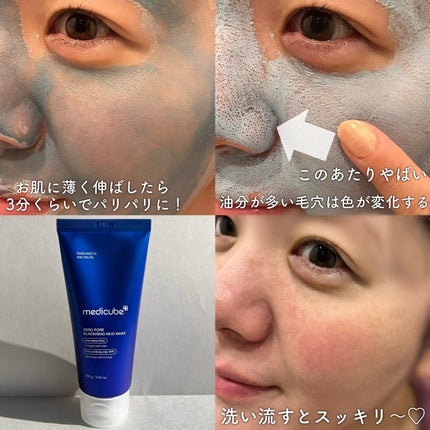 ひみ ✿ on LIPS 「medicube新作📣✨✨真っ青!なクレイマスクで毛穴つるん💙..」(4枚目)