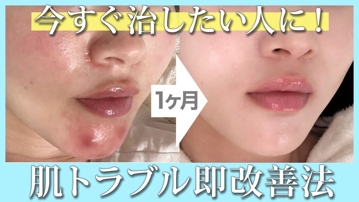 レチノール エキスパート0.1%/IOPE/美容液を使ったクチコミ(1枚目)