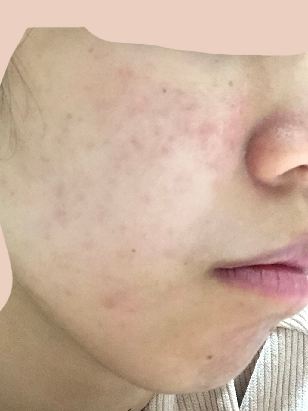 乳液・敏感肌用・高保湿タイプ/無印良品/乳液を使ったクチコミ(2枚目)