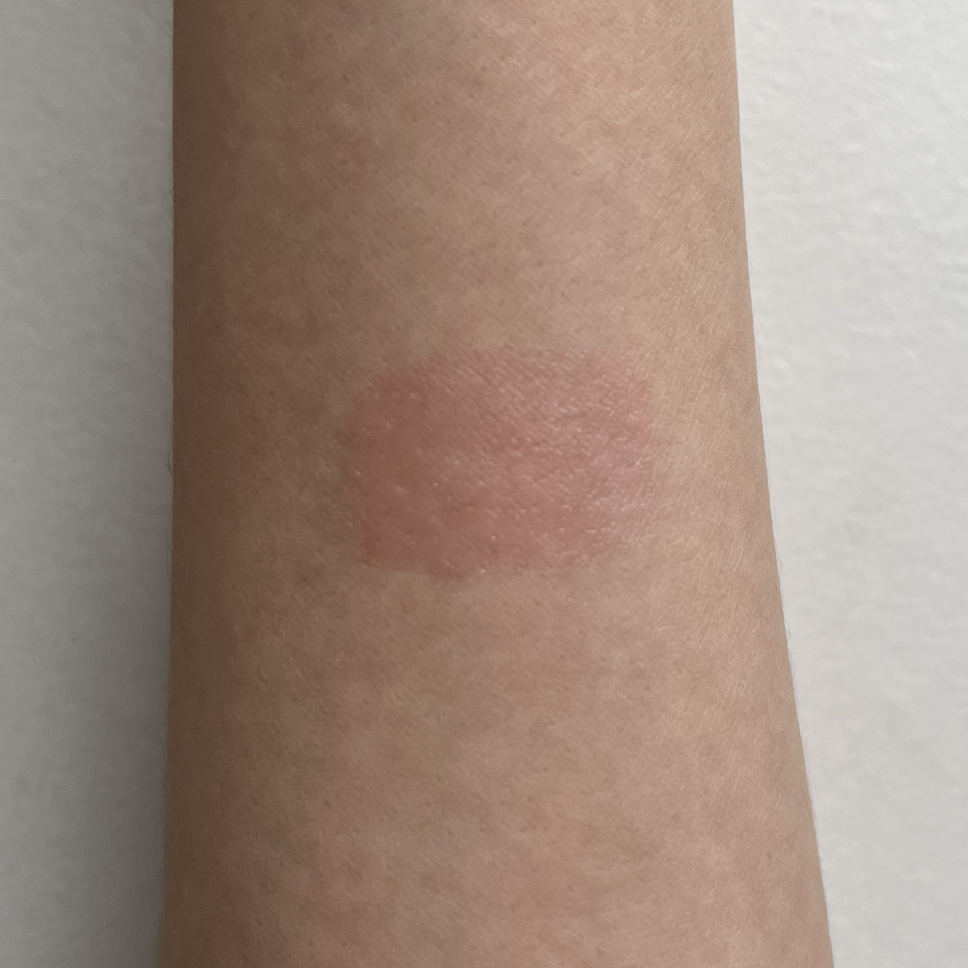 ティントリップレスキュー/FRESHO2/リップバームを使ったクチコミ（3枚目）