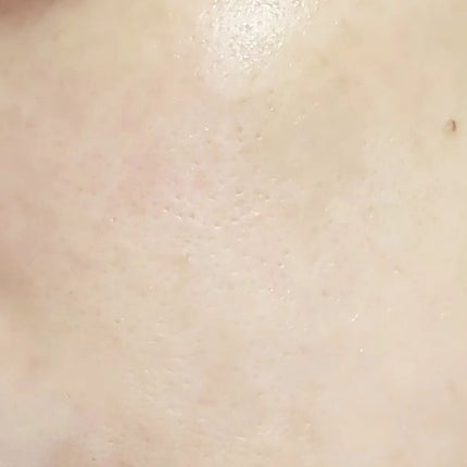 オルビスユー エッセンスローション /オルビス/化粧水を使ったクチコミ(7枚目)