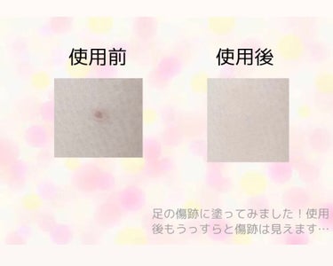 スポッツカバー ファウンデイション/SHISEIDO/クリームコンシーラーを使ったクチコミ（2枚目）