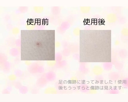 スポッツカバー ファウンデイション/SHISEIDO/クリームコンシーラーを使ったクチコミ(2枚目)
