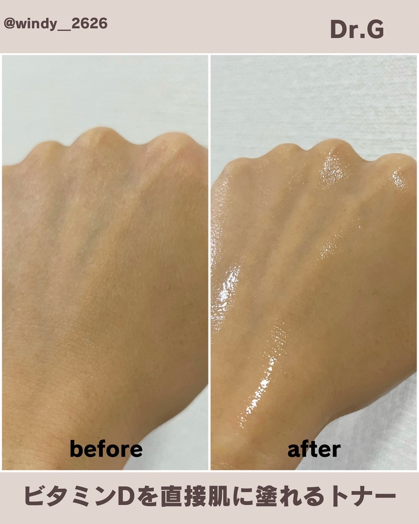 ザモイスチャーバリアDリキッドトナー/Dr.G/化粧水を使ったクチコミ(4枚目)