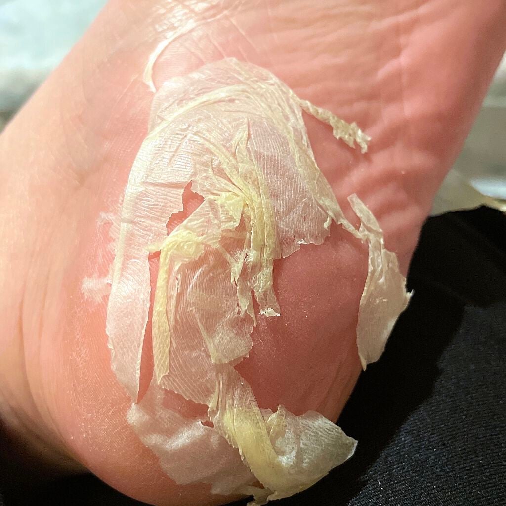 かかと どうスルん??そうスルんDX/Stay Free/レッグ・フットケアを使ったクチコミ(7枚目)