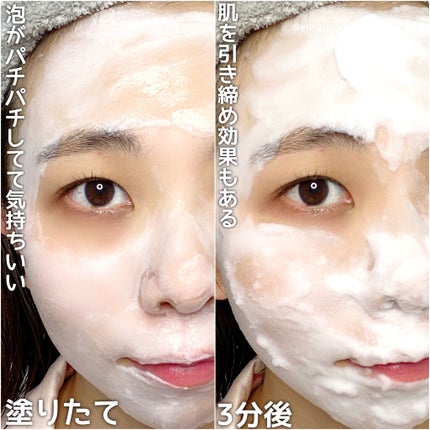 優奈 on LIPS 「\エステ並みのスペシャルケア/くすみ・引き締め・肌トーンアップ..」(4枚目)