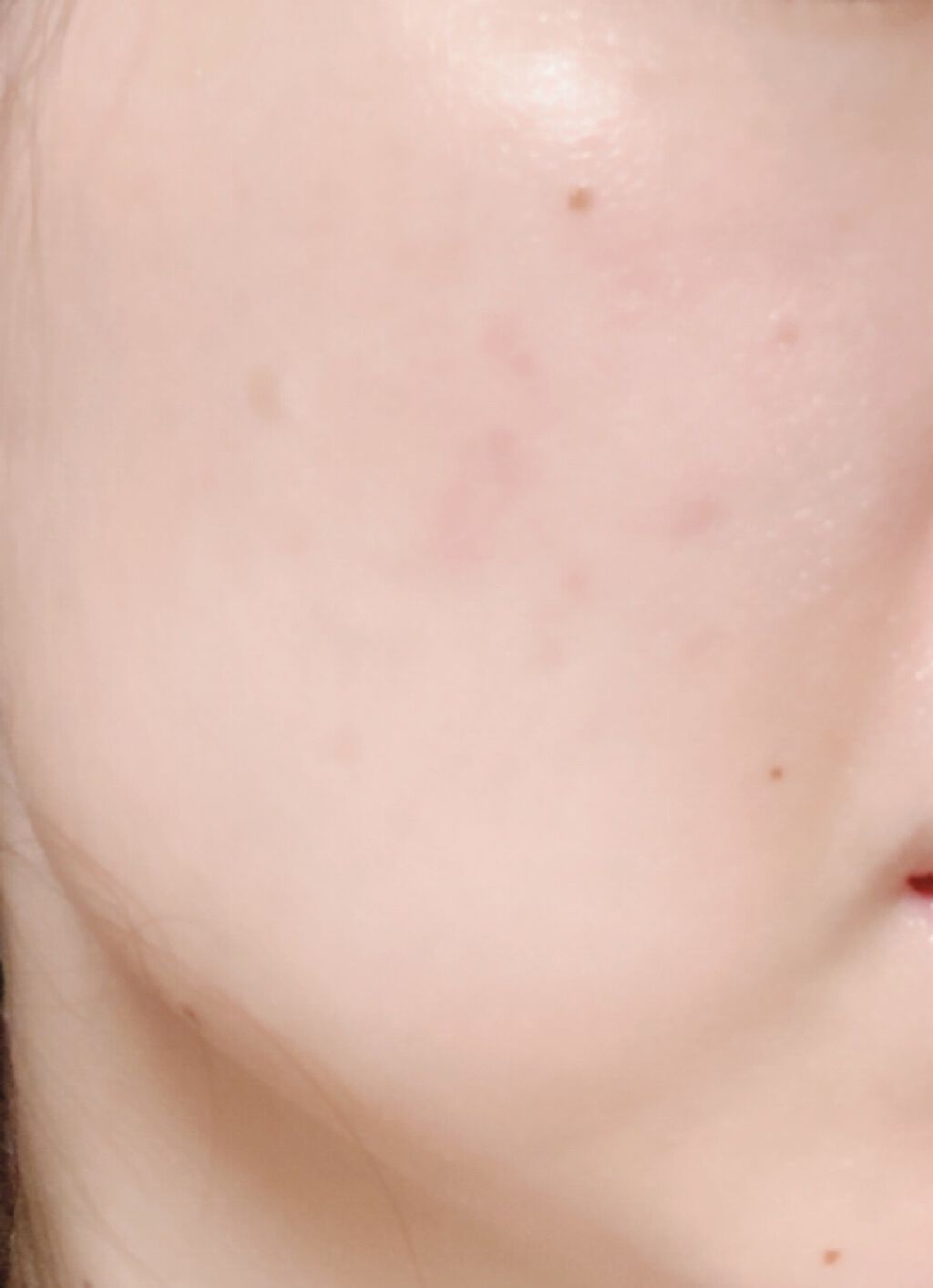 モイストバランス  ローション/ACSEINE/化粧水を使ったクチコミ（3枚目）