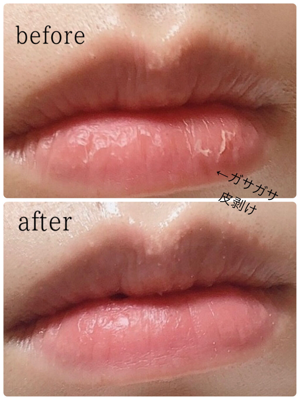 リップシュガースクラブモイストa/K-パレット/リップスクラブを使ったクチコミ（2枚目）