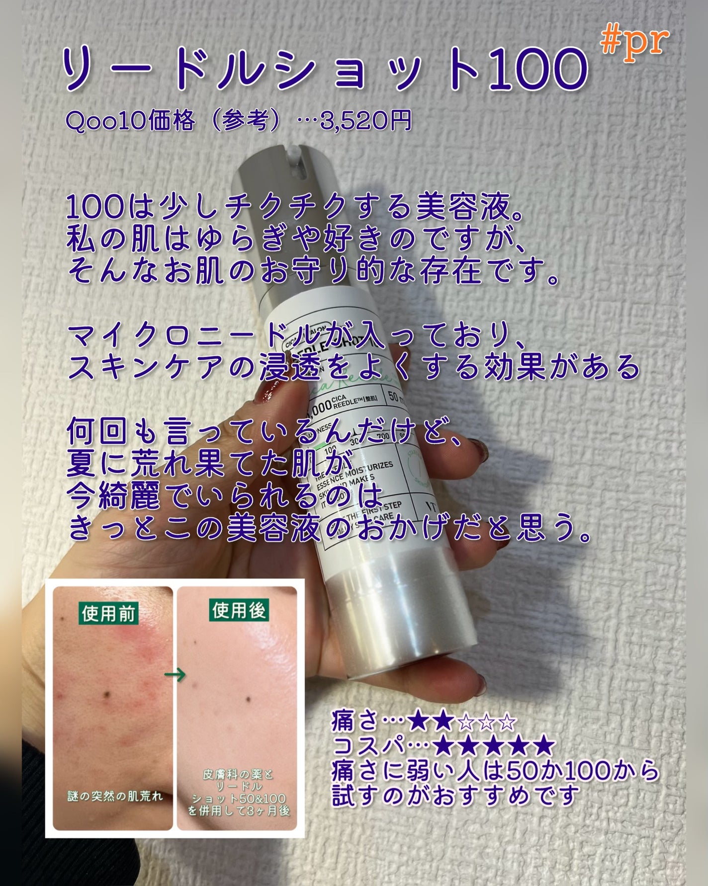 リードルショット100/VT/美容液を使ったクチコミ(4枚目)