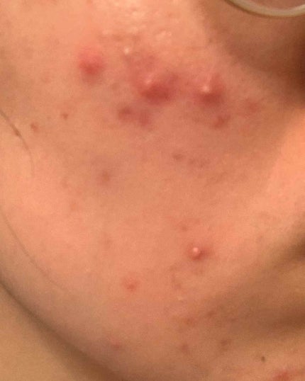 化粧水・敏感肌用・高保湿タイプ/無印良品/化粧水を使ったクチコミ(1枚目)