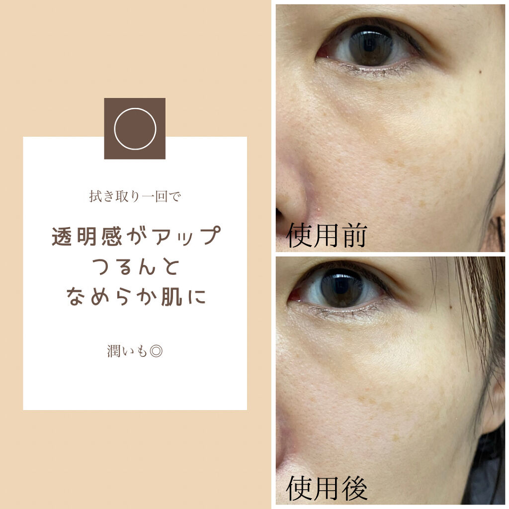 ガラクトミークリアスキンパッド/manyo/トナーパッドを使ったクチコミ（2枚目）