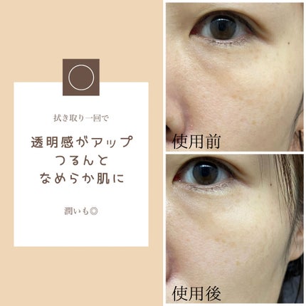 ガラクトミークリアスキンパッド/manyo/トナーパッドを使ったクチコミ(2枚目)