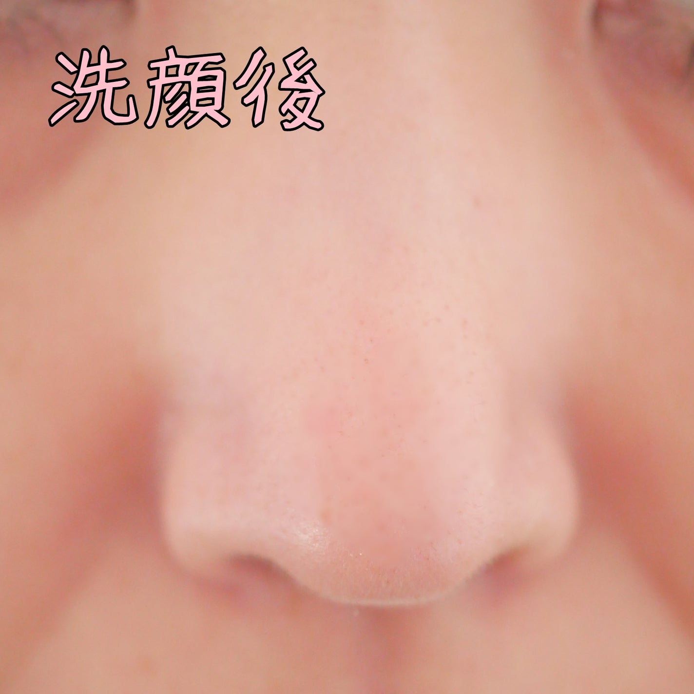 薬用VC泡フォーマー/VCシリーズ/洗顔フォームを使ったクチコミ(9枚目)