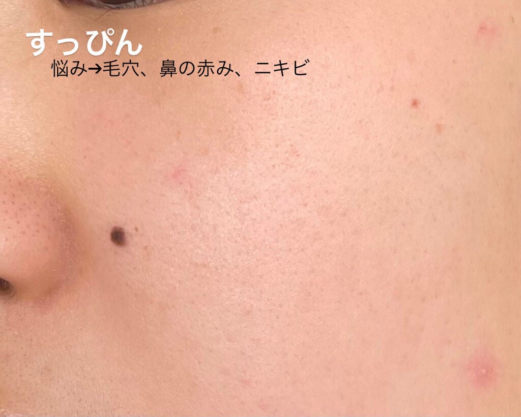 フィットミー コンシーラー/MAYBELLINE NEW YORK/リキッドコンシーラーを使ったクチコミ(3枚目)