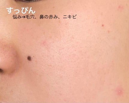 フィットミー コンシーラー/MAYBELLINE NEW YORK/リキッドコンシーラーを使ったクチコミ(3枚目)