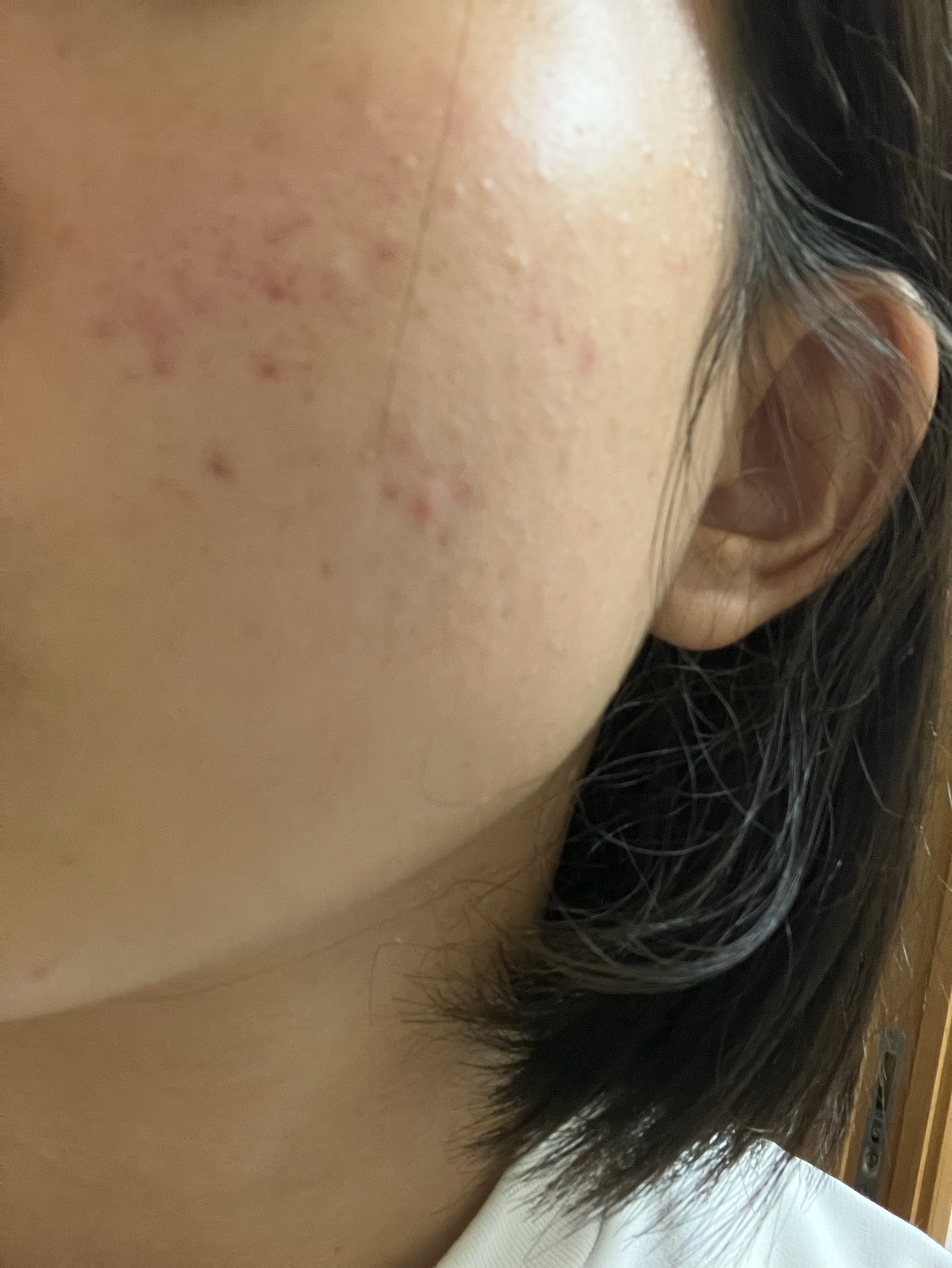 薬用スキンミルク/オードムーゲ/乳液を使ったクチコミ（3枚目）