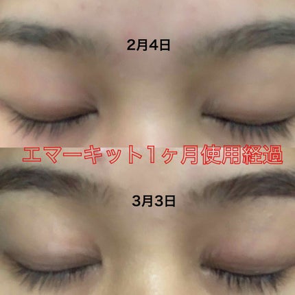 EMAKED(エマーキット)/水橋保寿堂製薬/まつげ美容液を使ったクチコミ(1枚目)