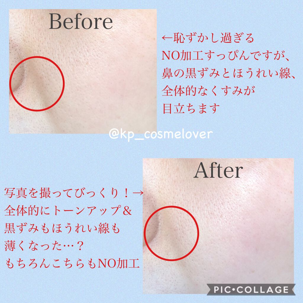 PLUMINUS/mous./美顔器・マッサージを使ったクチコミ(8枚目)